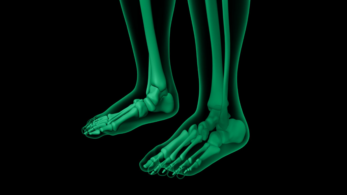 4 ways to figure out your foot fails. Part 2